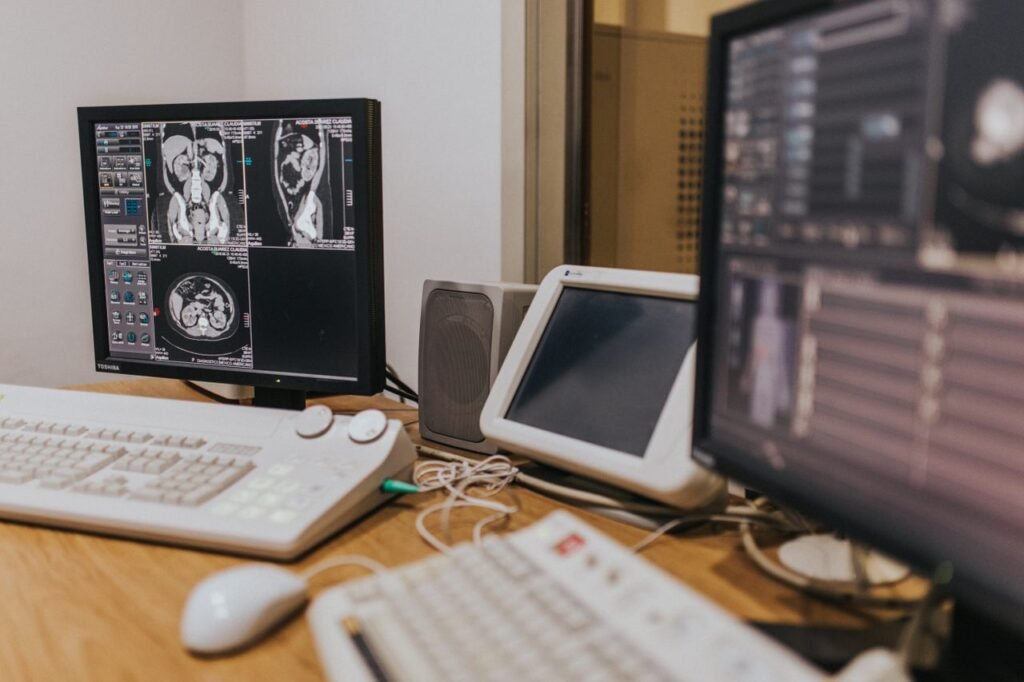 Medical imaging setup with MRI scans on multiple screens in a healthcare facility.